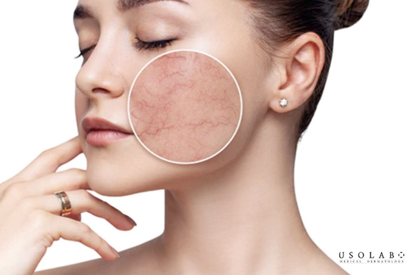 dầu dừa có tẩy trang được không