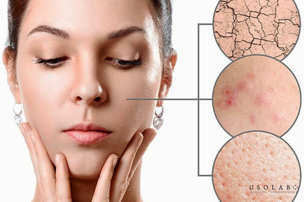 dầu dừa có tẩy trang được không