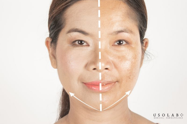 kem dưỡng trắng body cho phụ nữ sau sinh