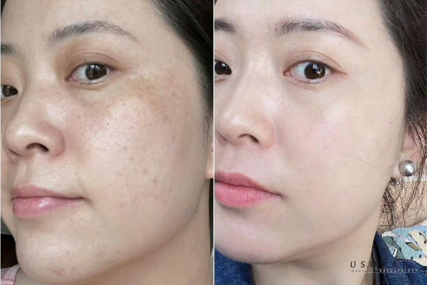 kem dưỡng trắng body cho phụ nữ sau sinh