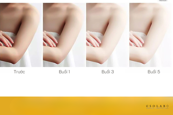 kem ủ trắng sữa dê có hiệu quả không