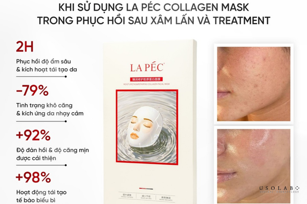mặt nạ trắng da se khít lỗ chân lông