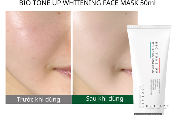 mặt nạ trắng da se khít lỗ chân lông