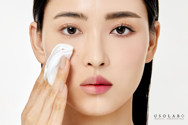 nên dùng dầu tẩy trang hay nước tẩy trang