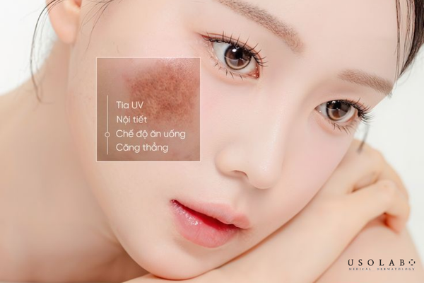 phác đồ dưỡng trắng da mặt cho clinic