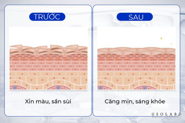 phác đồ dưỡng trắng da mặt cho clinic