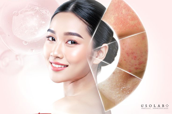 phác đồ dưỡng trắng da mặt cho clinic