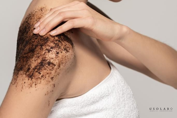 cách trị sạm da body tại nhà hiệu quả