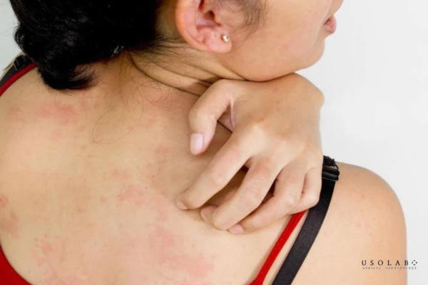 ủ trắng da có hại không