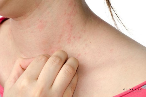 ủ trắng da có hại không