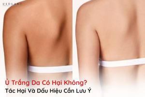 ủ trắng da có hại không