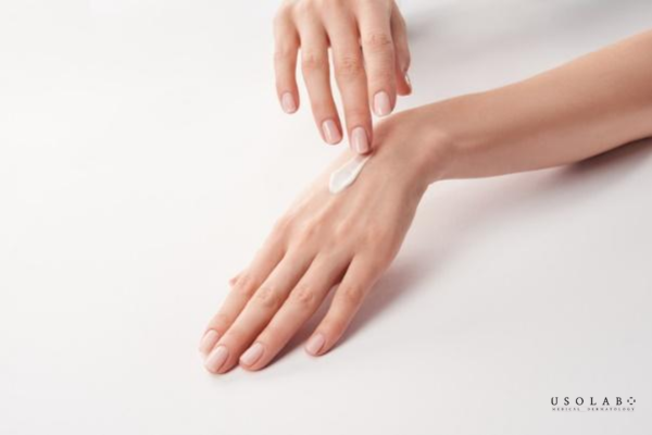 erythema là gì