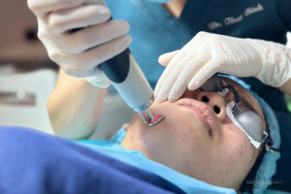 chăm sóc da sau laser