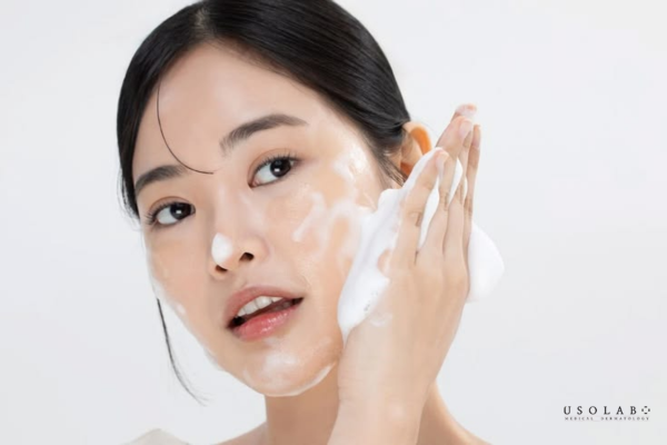 mặt đỏ sau laser