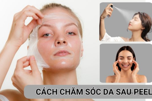 da bị khô căng sau peel