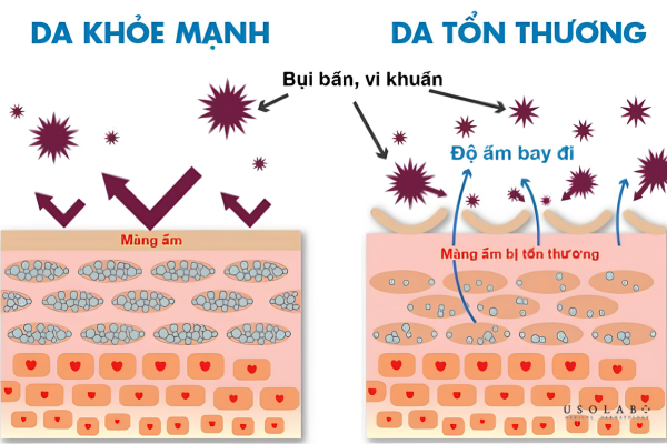 da bị tổn thương hàng rào bảo vệ