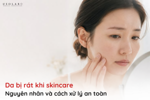da bị rát khi skincare