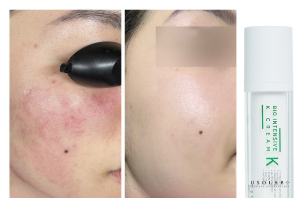 thành phần trong kem dưỡng da giảm đỏ rát