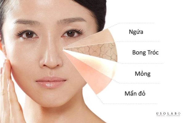 hàng rào bảo vệ da là gì