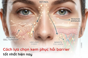 kem phục hồi barrier tốt nhất