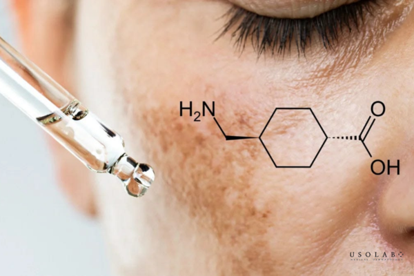 tranexamic acid trong kem ủ trắng có tác dụng gì