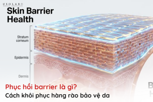 phục hồi barrier là gì