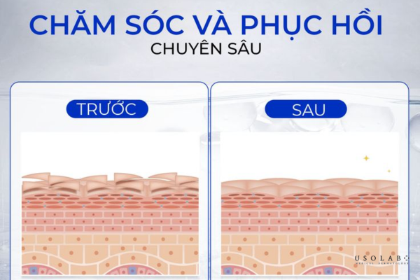 phục hồi sinh học cho da