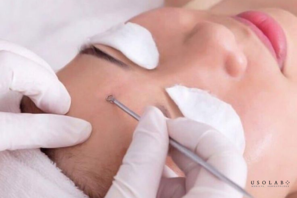 routine phục hồi da sau treatment