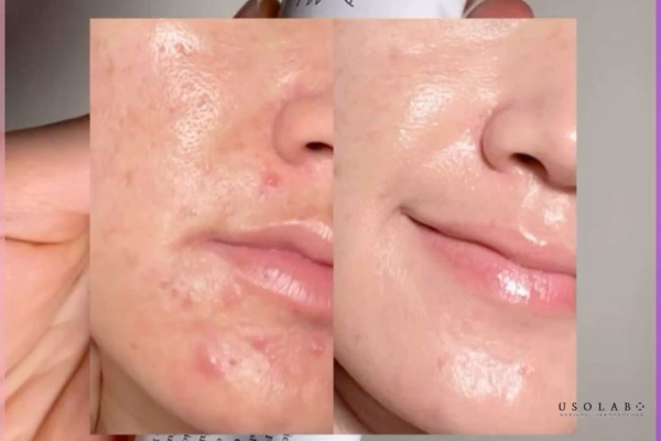 kem phục hồi da tốt nhất