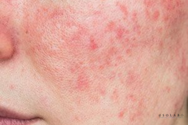 kem phục hồi da tốt nhất