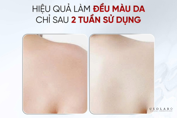 ủ trắng body mấy lần một tuần là đủ