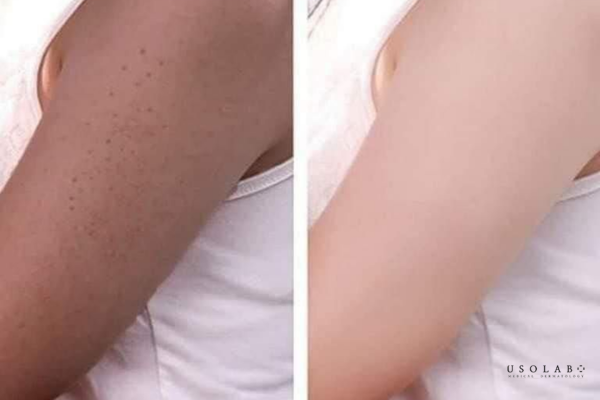 ủ trắng body mấy lần một tuần là đủ
