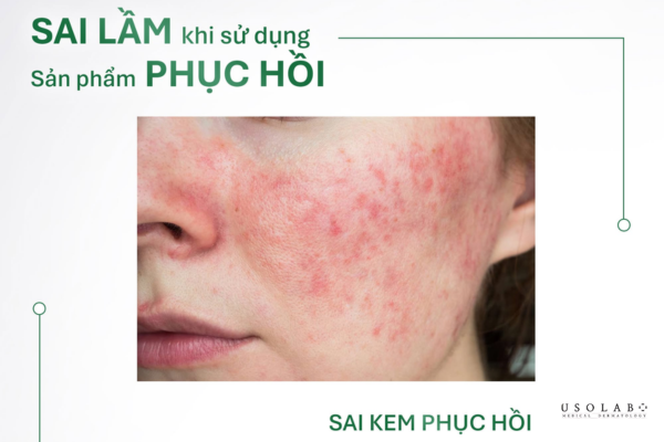 vì sao da đỏ mãi không hết