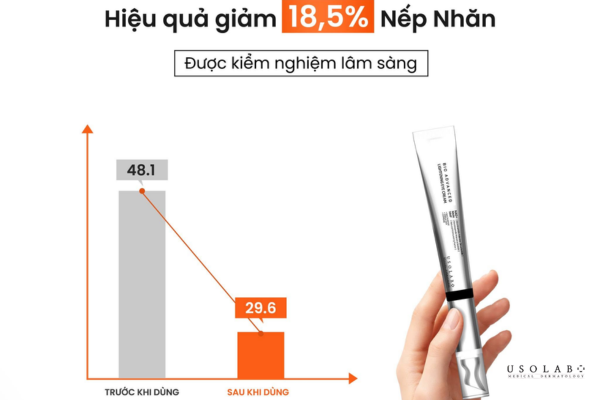 kem mắt nào tốt cho tuổi 40