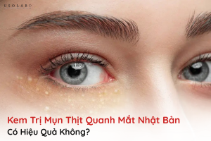 kem trị mụn thịt quanh mắt nhật bản