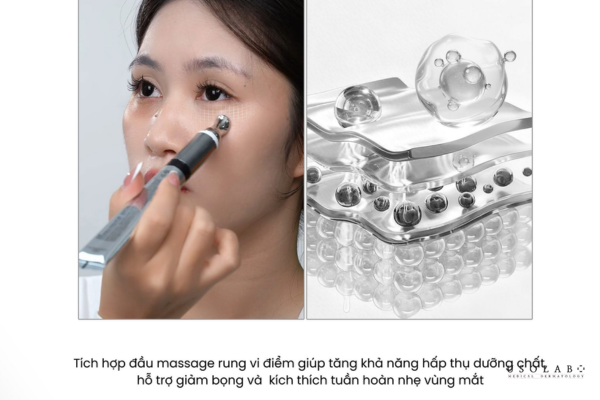 kem xóa bọng mắt vĩnh viễn