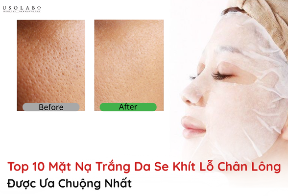 mặt nạ trắng da se khít lỗ chân lông