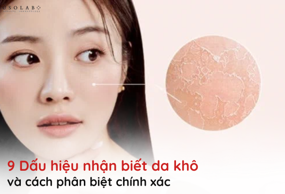 dấu hiệu nhận biết da khô
