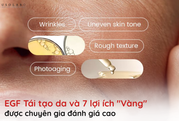 EGF tái tạo da