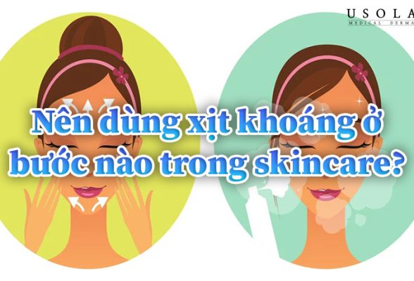 Nên dùng xịt khoáng ở bước nào trong skincare