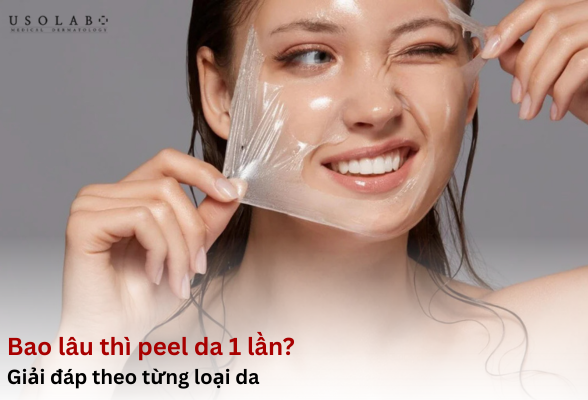 Bao lâu thì peel da 1 lần