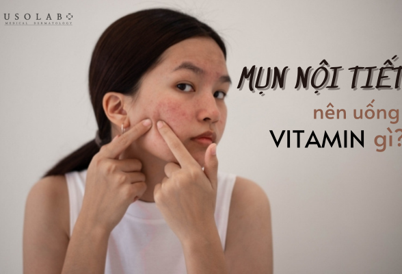 bị mụn nội tiết nên uống vitamin gì