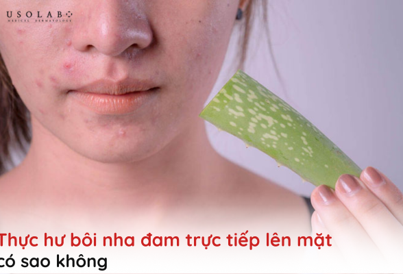 bôi nha đam trực tiếp lên mặt có sao không