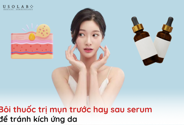 bôi thuốc trị mụn trước hay sau serum