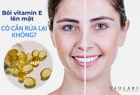 bôi vitamin e lên mặt có cần rửa lại không