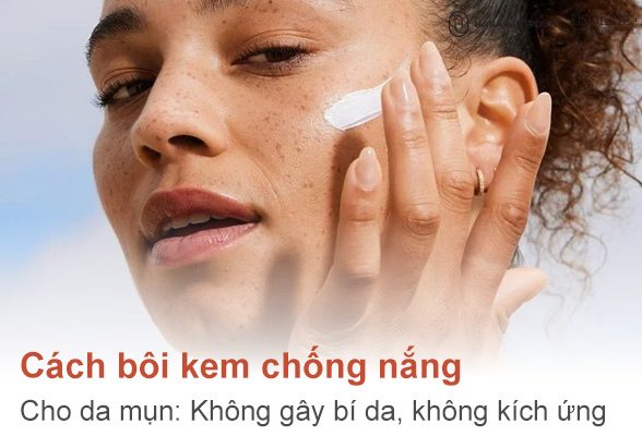Cách bôi kem chống nắng cho da mụn: Không gây bí da, không kích ứng