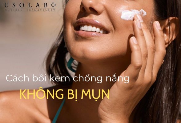 Cách bôi kem chống nắng không bị mụn giúp bảo vệ làn da mịn màng