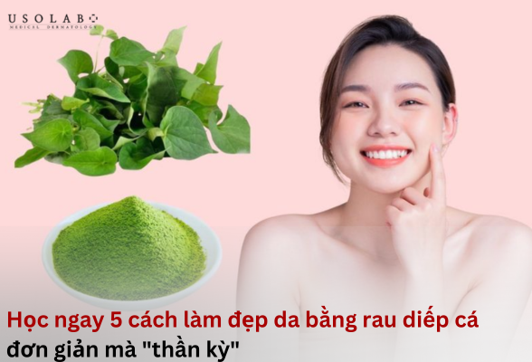 cách làm đẹp bằng rau diếp cá