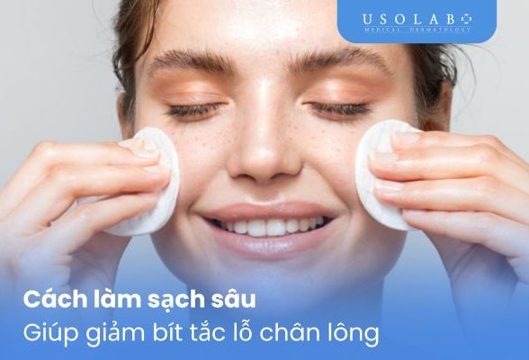 Cách làm sạch sâu giúp giảm bít tắc lỗ chân lông