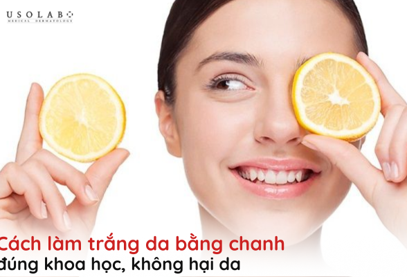 cách làm trắng da bằng chanh